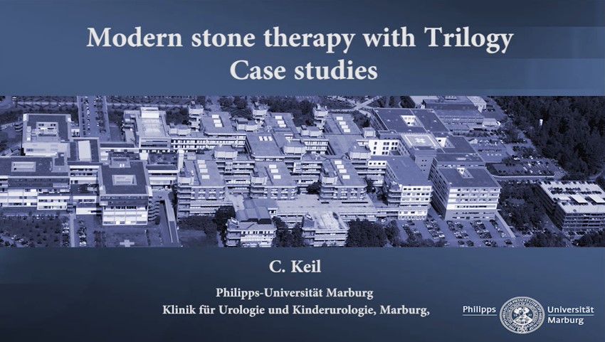 Updates in stone management with Swiss LighoClast Trilogy
