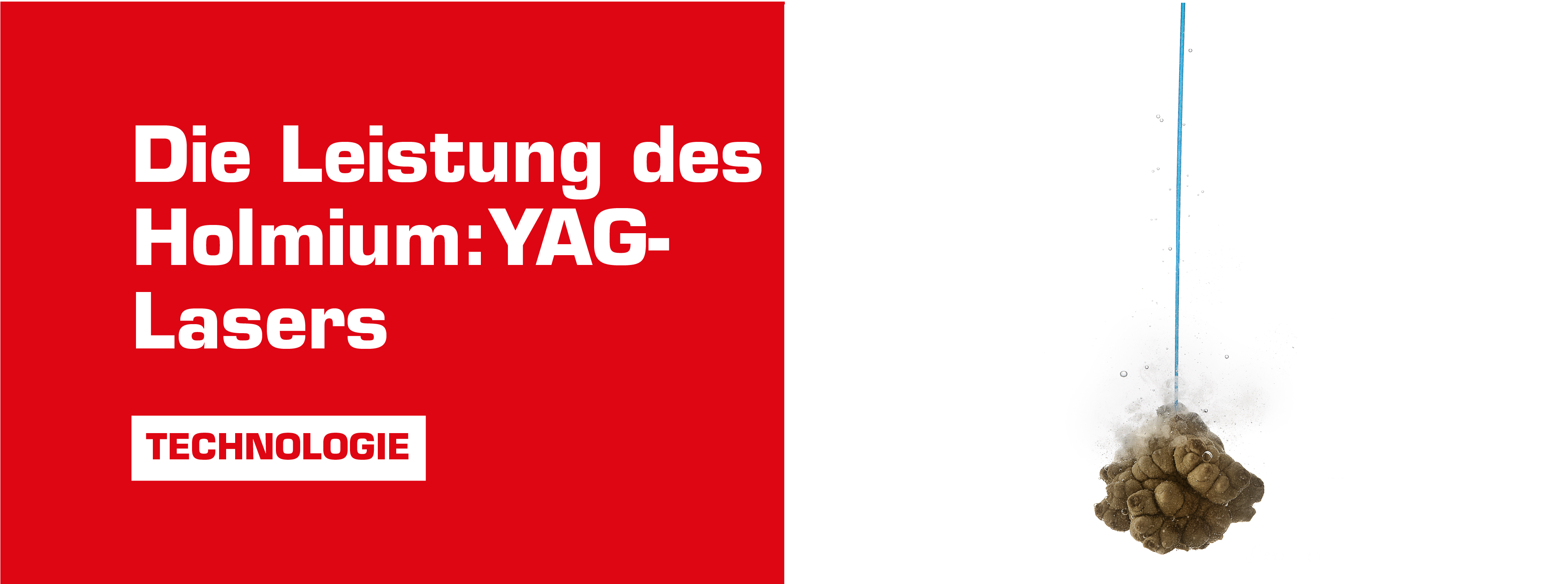 ho:yag