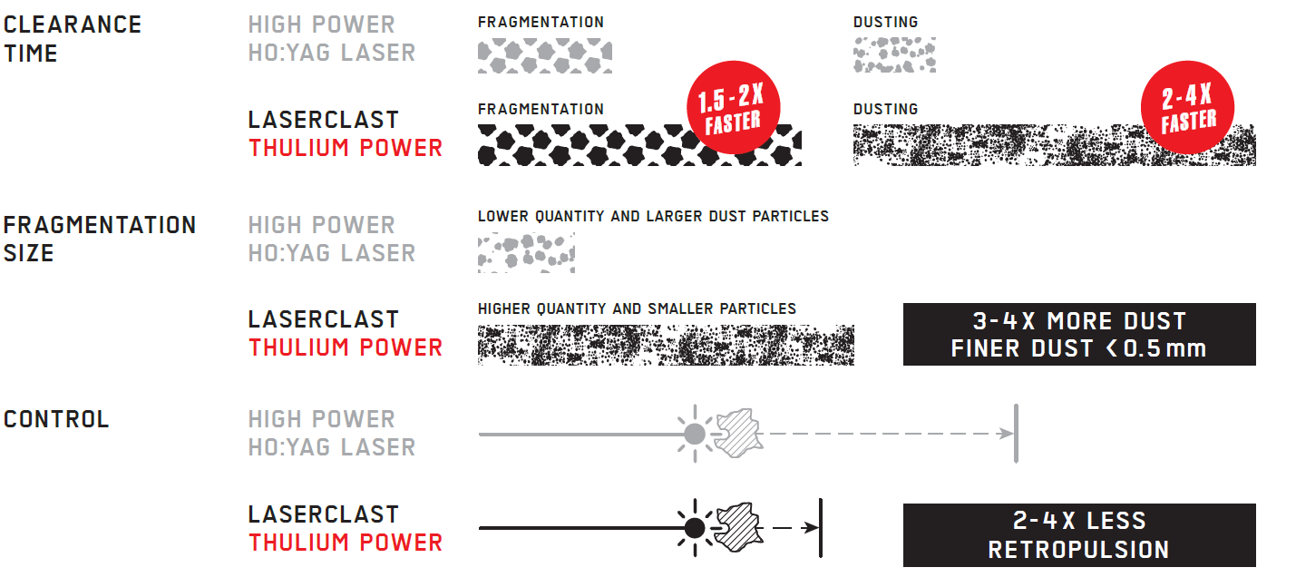 LaserClast Thulium Power - Revolution for stone treatment