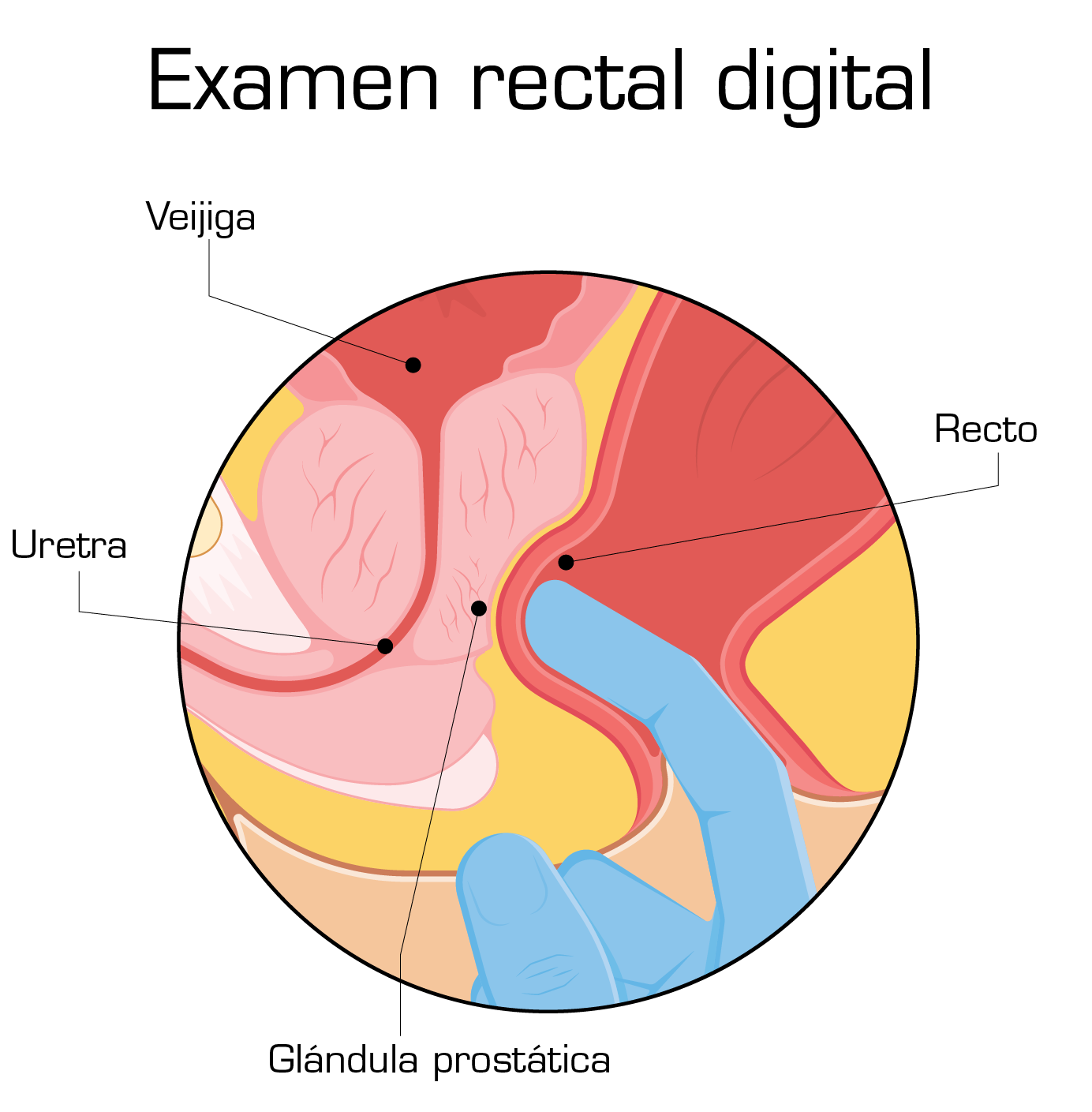 digital rectal exam
