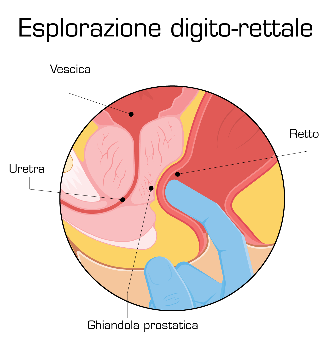 digital rectal exam